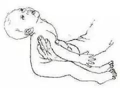 怎么判断宝宝肌张力是不是正常,医生怎么给宝宝肌张力评估