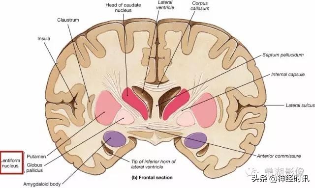 基底节ct解剖示意图,影像解剖图谱怎么用