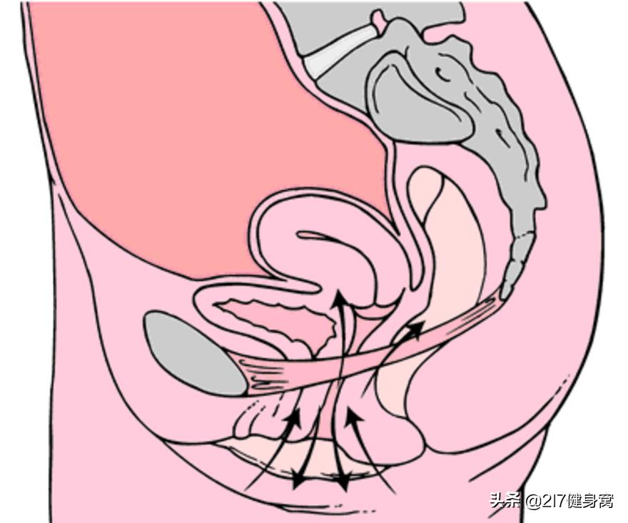 漏尿动作凯格尔运动锻炼,凯格尔运动治疗漏尿