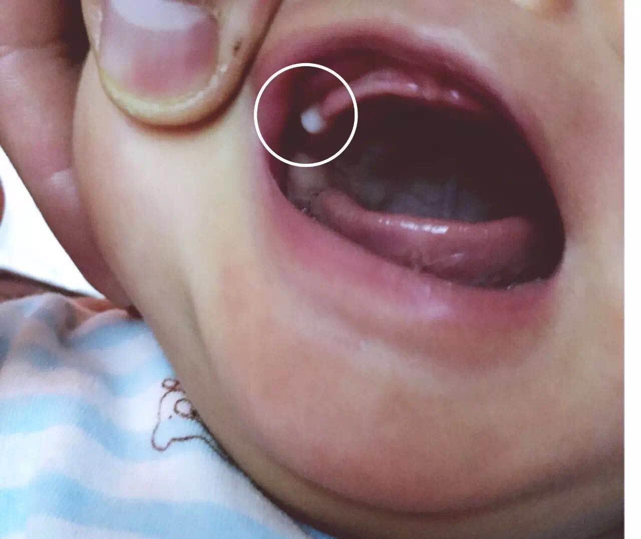 刚出生的宝宝特殊现象,刚出生宝宝吓住了怎么办