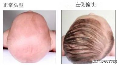 宝宝偏头睡觉怎么纠正最有效,一岁宝宝偏头睡觉如何矫正