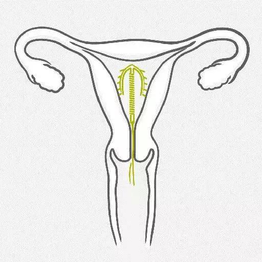 哺乳期妈妈如何避孕最有效,哺乳期没避孕怎么办