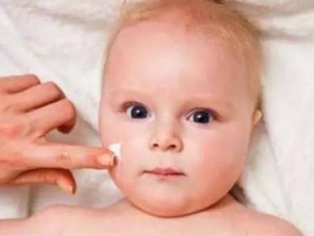 怎么治疗宝宝湿疹最快方法,宝宝湿疹小妙招