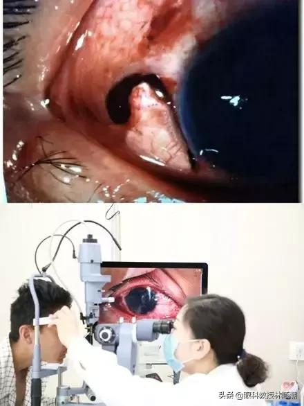 22岁小伙被球击中左眼,19岁男孩被篮球砸脑袋