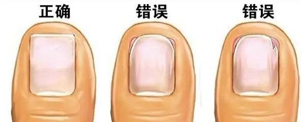 女人美甲到底该不该做,美甲指甲表面开裂是怎么回事