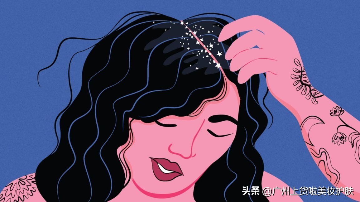 头皮经常发痒怎么办,头皮总是痒是什么原因怎么缓解