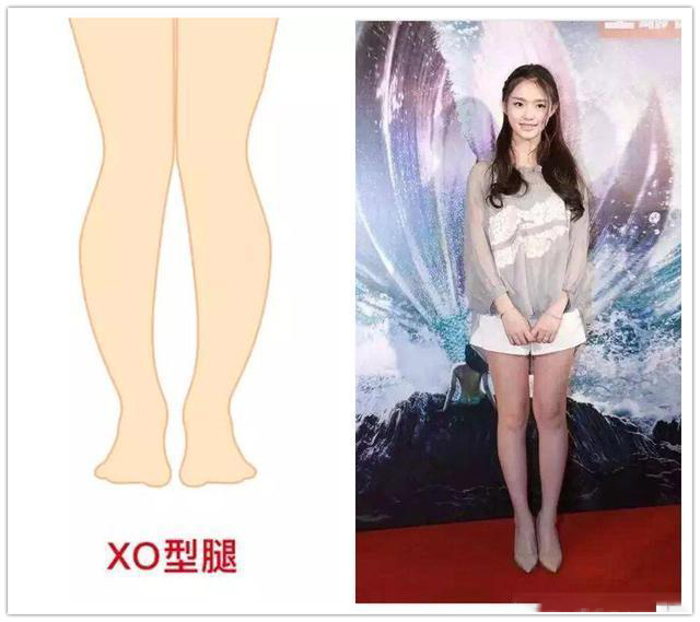 女生腿粗的最好方法,针对3种粗腿类型的最佳瘦腿方法