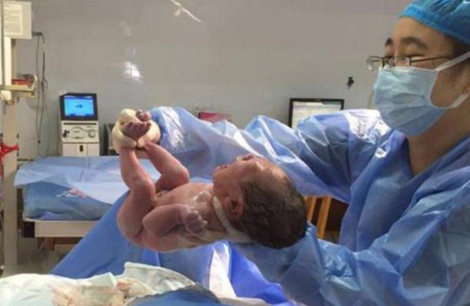 顺产对妈妈和胎儿都比较好,为何很多孕妇还是会选择坚持顺产