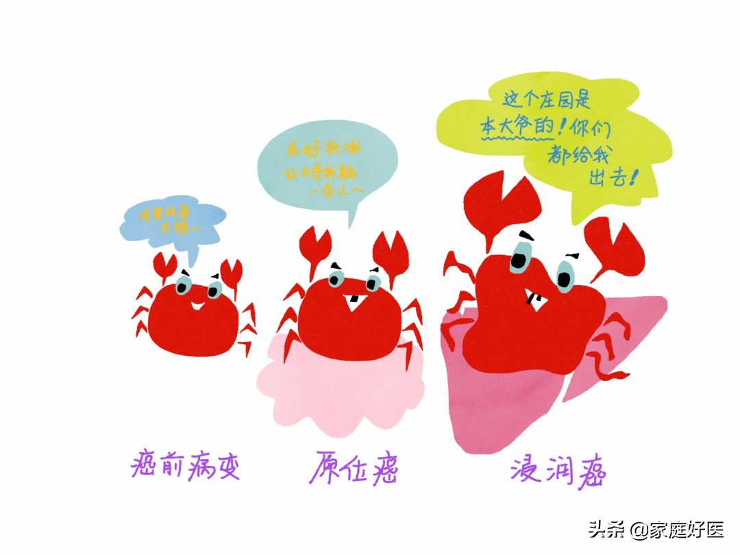 癌症来之前，都会经历癌前病变！可惜很多人没重视…​
