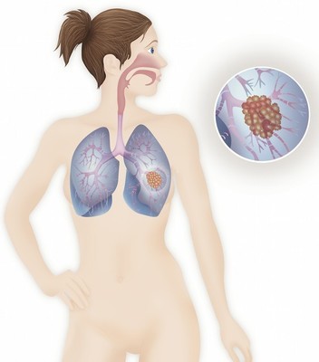 寒性体质的解决方法,寒性体质怎么调理才能去寒
