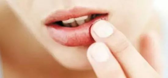 孕妇嘴角长小水泡是不是上火了,孕妇嘴角有泡泡怎么回事