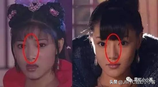 鼻子怎么修复好看呢,鼻型修复方法大全