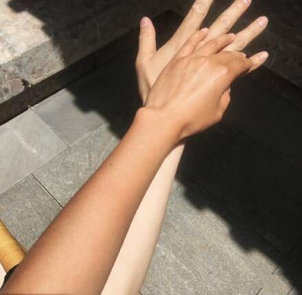 脖子被太阳晒黑了怎么才能变白,被太阳晒黑怎样变白女生