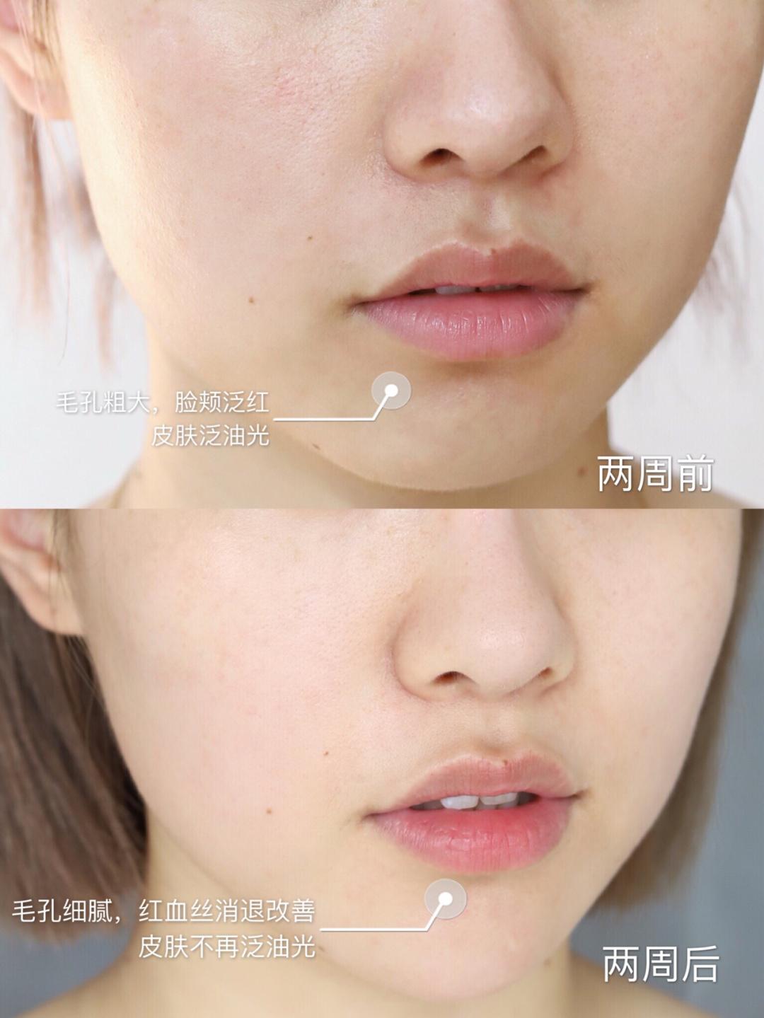 包文婧推荐的护肤品,包文婧用的哪些化妆品