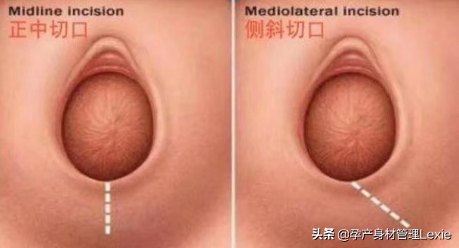 产后盆骨肌训练视频,孕妇骨盆底肌训练方法