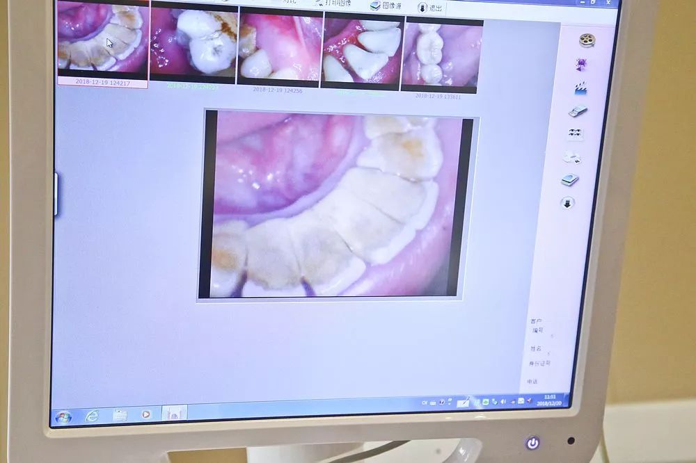 让你笑出自信的不止益达！仅39.9元抢成都华品口腔保健洁牙套餐！