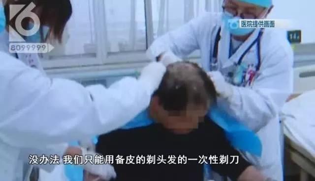 男子错拿敌敌畏洗头,长沙一男子拿敌敌畏洗头