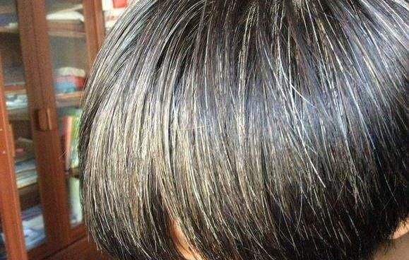 少白头头发白了有什么方法变黑,吃黑参可改善白发吗