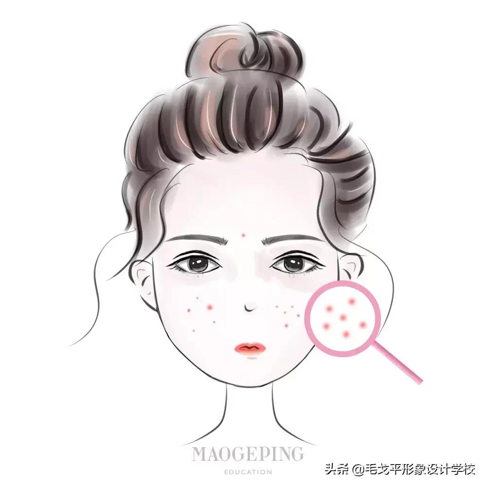 酒精毁脸的症状,酒精损坏皮肤