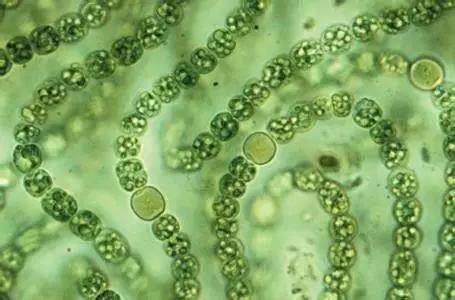 水产养殖藻类老化是怎样的,水产养殖显微镜下各种藻类