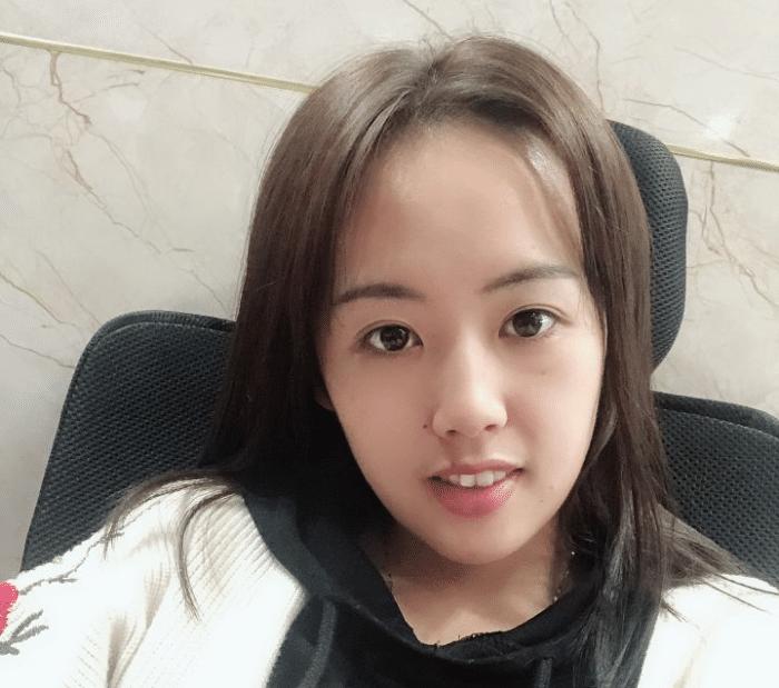 牙套隐形日记,牙套日记正颌