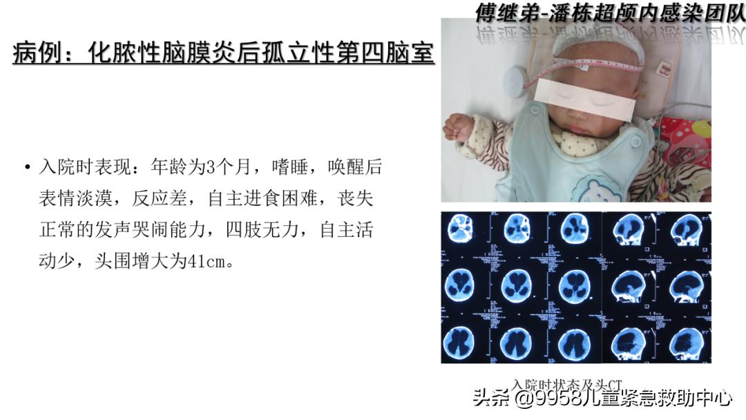 颅内感染康复治疗知识,小儿颅内感染的健康宣教