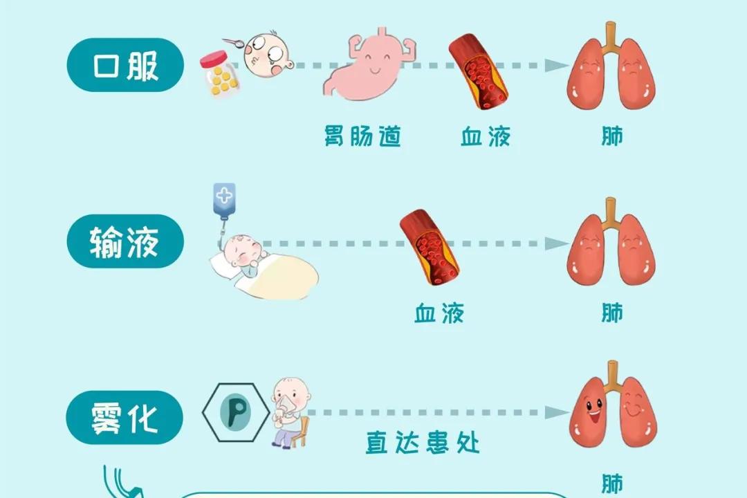 小儿雾化吸入注意事项,药讲什么内容