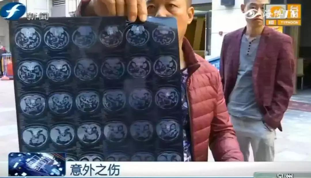 学问｜常见的摔倒竟有这么多的追偿方式