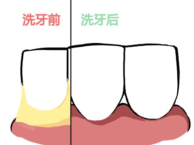 梦里牙齿松动自己拔掉,儿童牙齿松动怎么拔掉