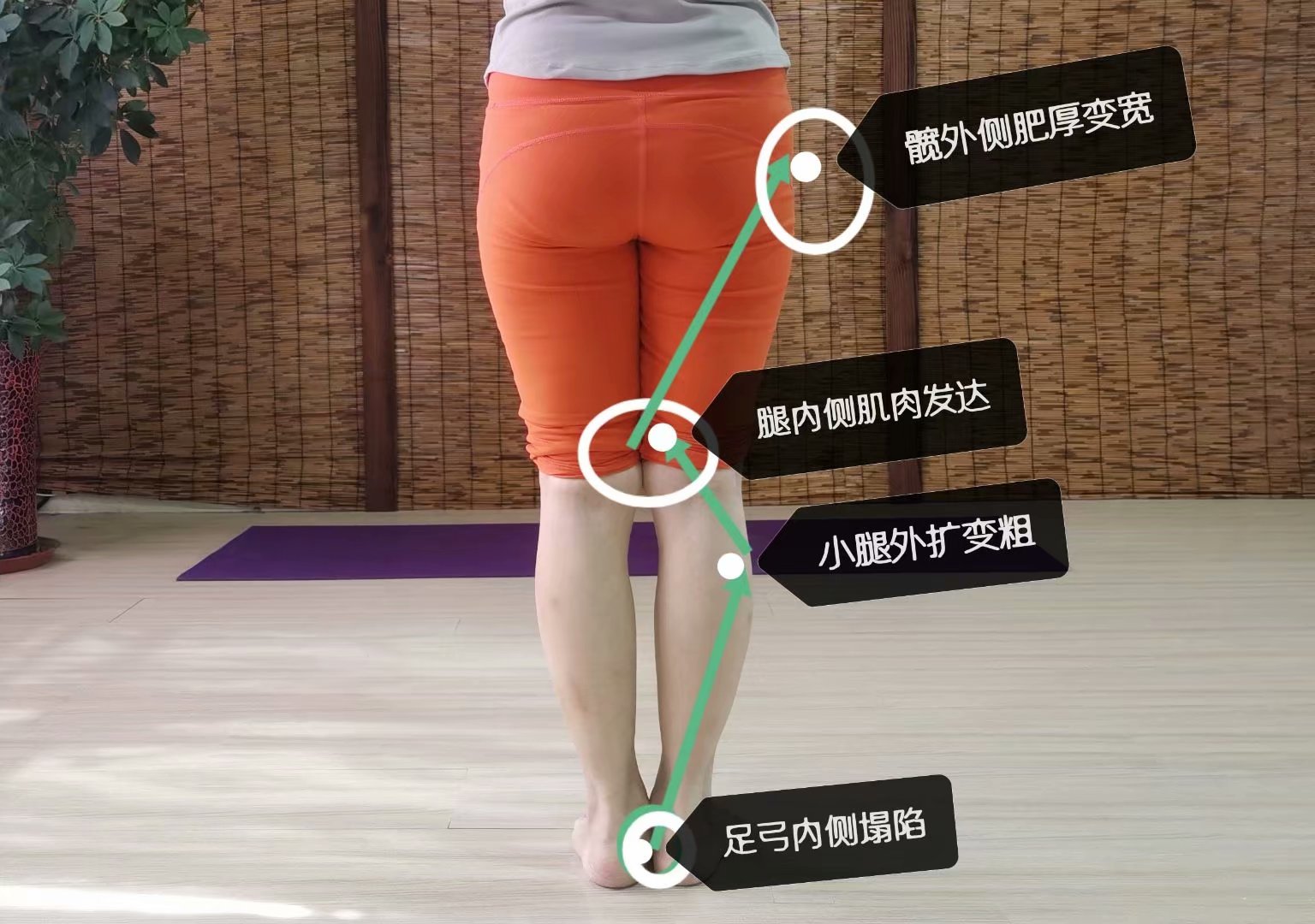 小腿粗怎么走路瘦小腿,怎么走路能瘦小腿肌肉