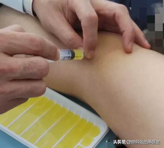 花椒和白醋对关节炎积液有效果吗,盐加花椒热敷膝关节积液管用吗