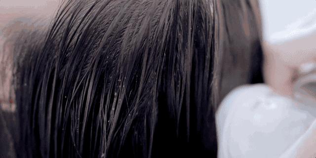 头皮干燥头屑多用什么护发,冬季头皮干燥头屑多怎么办