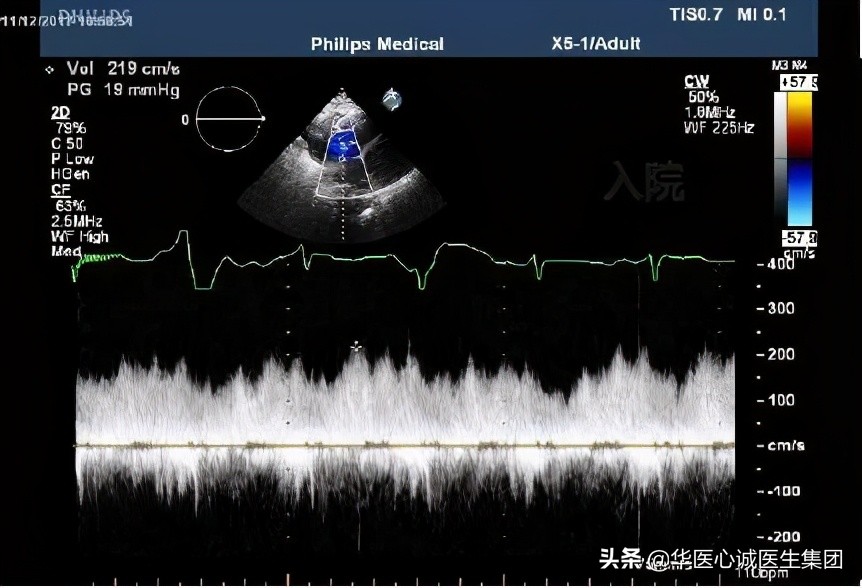 杨颖局部图,杨颖早期下颌宽大