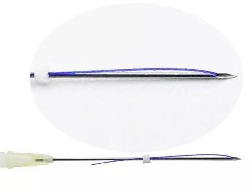 科普线雕会有哪些后遗症,线雕解密