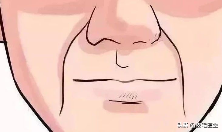 笑出法令纹!还能肆无忌惮地笑吗?正常笑!但改掉这5个习惯