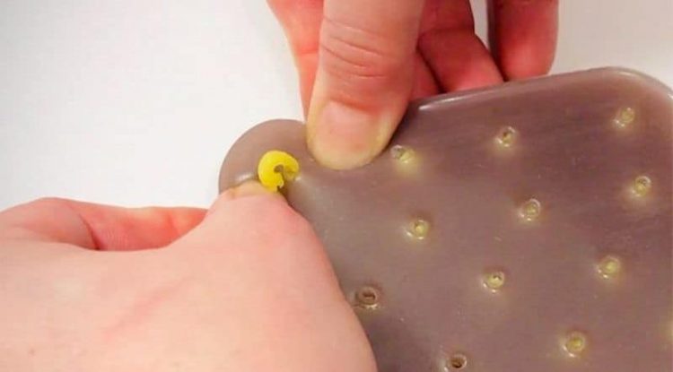 挤黑头挤痘痘神奇工具,用挤痘痘工具挤黑头