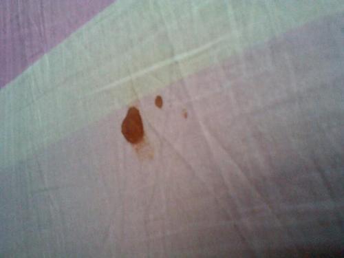 衣服有血渍怎样有效去血渍,血渍在衣服上干了怎么洗才能干净