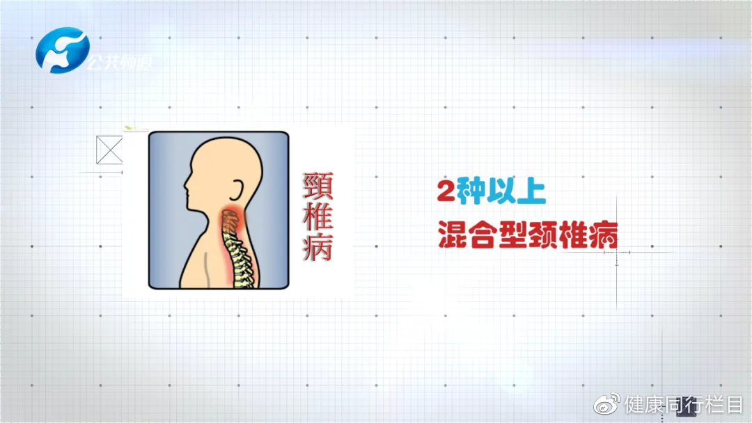 脊柱脊髓病的诊治,急性颈脊髓损伤怎么治疗