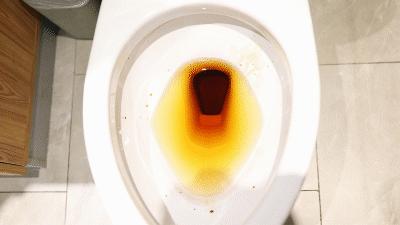 上厕所用湿纸巾擦有什么好处,上完厕所有纸巾正确擦法