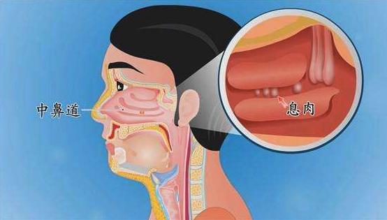 酉阳杂俎中的故事,酉阳杂俎讲什么