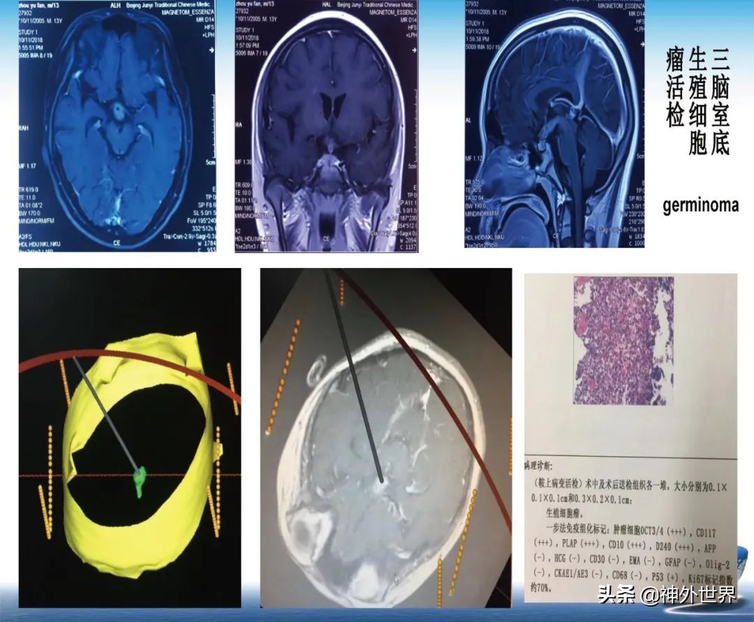 宣武医院神经外科王亚明祖籍,北京宣武医院神经科专家王亚明
