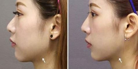 小米有必要击穿行业吗,小米有品能卖多少钱