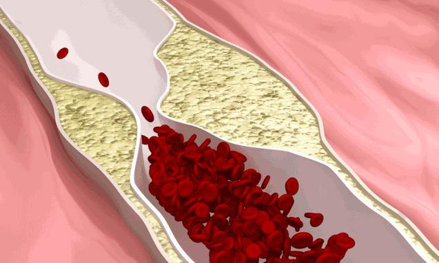 咖啡到底是“致癌”还是“治癌”？今天还它清白...