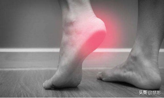 治疗足底筋膜炎最好的方法,足底筋膜炎治疗的正确方法