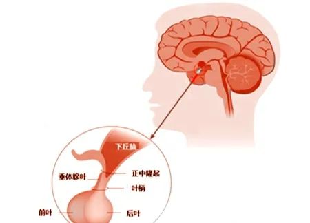 神经外科垂体瘤需要检查什么,神经外科垂体瘤科普图片