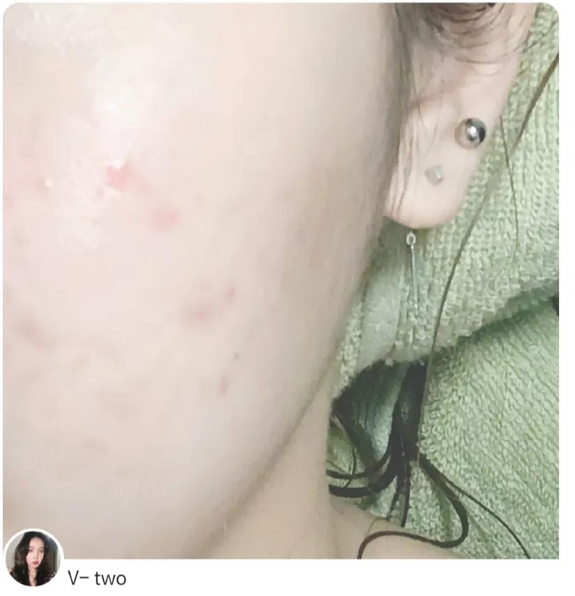 平价美白精华液深度测评,欧诗漫舒缓美白精华液测评