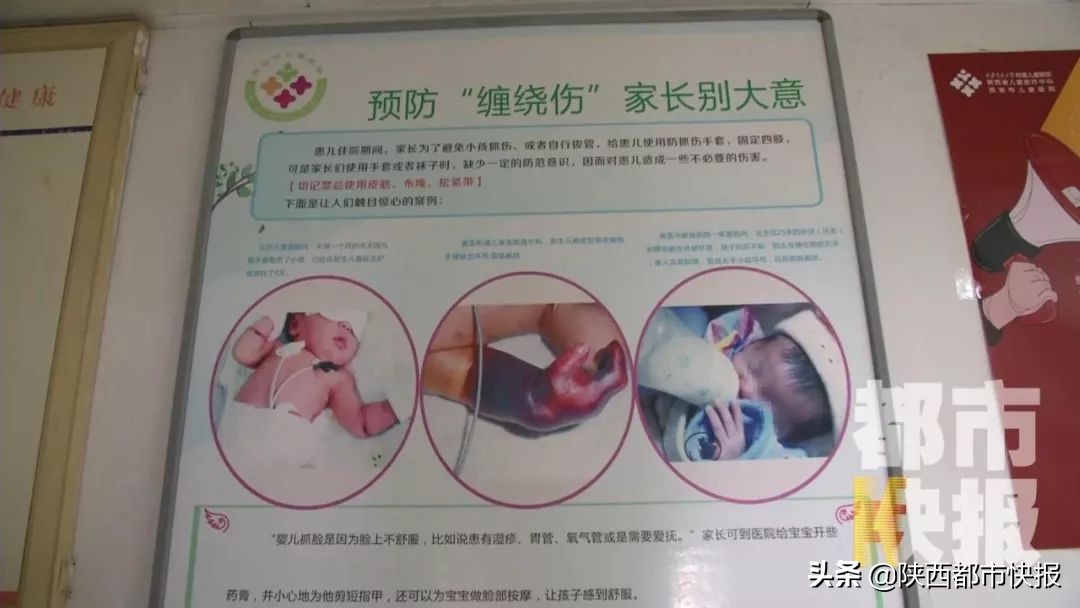 脚趾缺血坏死的原因,脚趾头缺血坏死