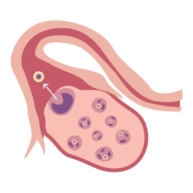 女人在美容院保养卵巢的正确方法,美容院的卵巢保养可靠吗