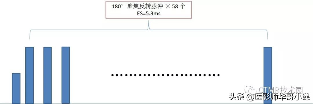 「MRI技术」磁共振伪影分析,了解下SSh_FLAIR序列