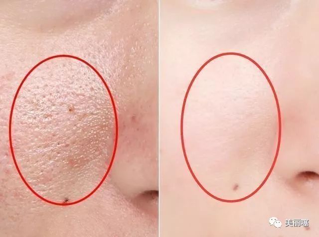 微商卖的大牌化妆品是真的吗,微商卖大牌化妆品为什么那么便宜